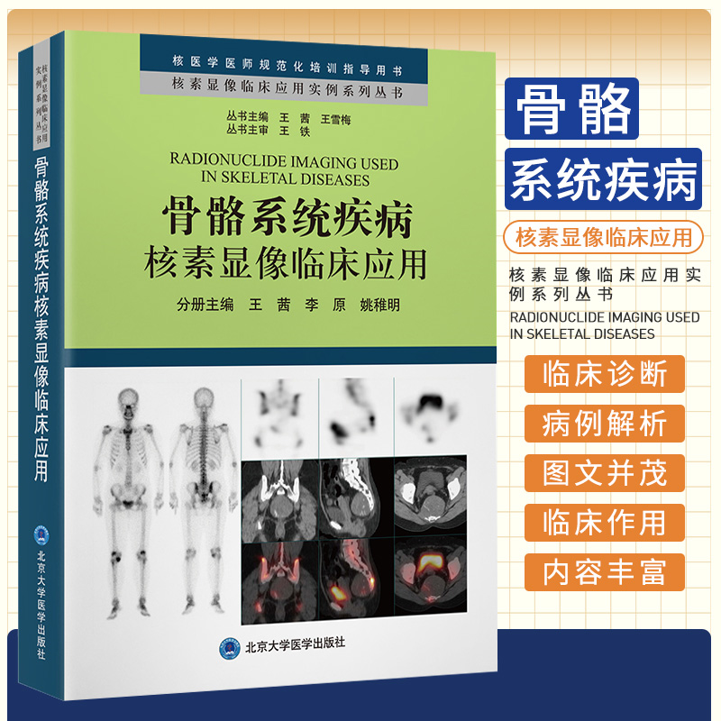 骨骼系统疾病核素显像临床应用 王茜 北京大学医学出版社 核素显像临床应用实例系列丛书 核医学医师规范化培训指导用书 书籍/杂志/报纸 医学其它 原图主图