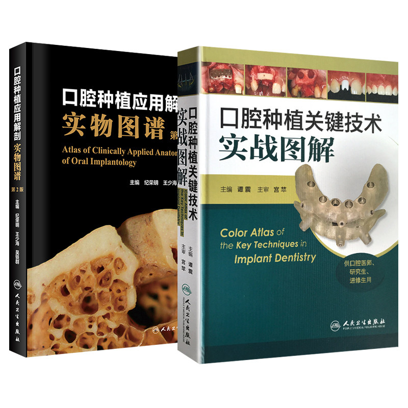 全2册 口腔种植关键技术实战图解+口腔种植应用解剖实物图谱 第2版  人民卫生出版社 口腔种植外科关键技术 口腔种植常规技术