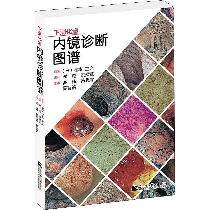 asy 下消化道内镜诊断图谱 (日)松本主之 ,谢威 祝建红 译 9787559123510 辽宁科学技术出版社