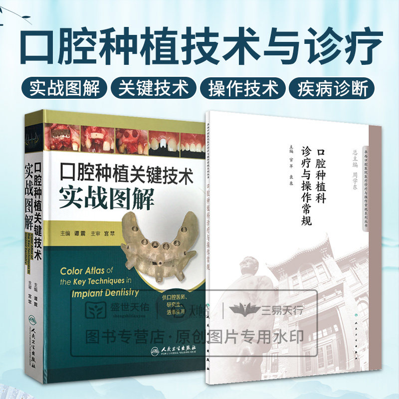 口腔种植关键技术实战图解+口腔种植科诊疗与操作常规 2本套装 供口腔医师 研究生 进修生用书口腔种植医学书医师临床用书彩图