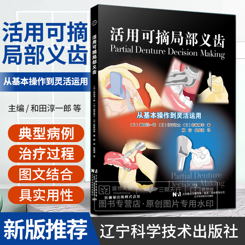 活用可摘局部义齿 从基本操作到灵活运用 和田淳一郎 辽宁科学技术出版社 可摘局部义齿的引入 固定桥修复改为可摘局部义齿修复