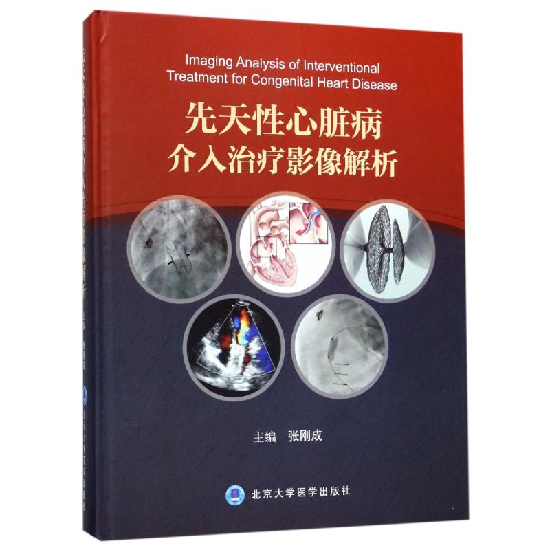 asy 先天性心脏病介入治疗影像解析 张刚成 主编 9787565915963 北京大学医学出版社