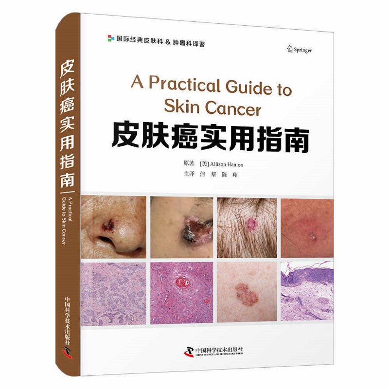 zgkj皮肤癌实用指南 何黎 陈翔 主译 中国科学技术出版社 9787504692252 皮肤肿瘤的高危人群与预防 鳞状细胞癌临床表现和鉴别诊断