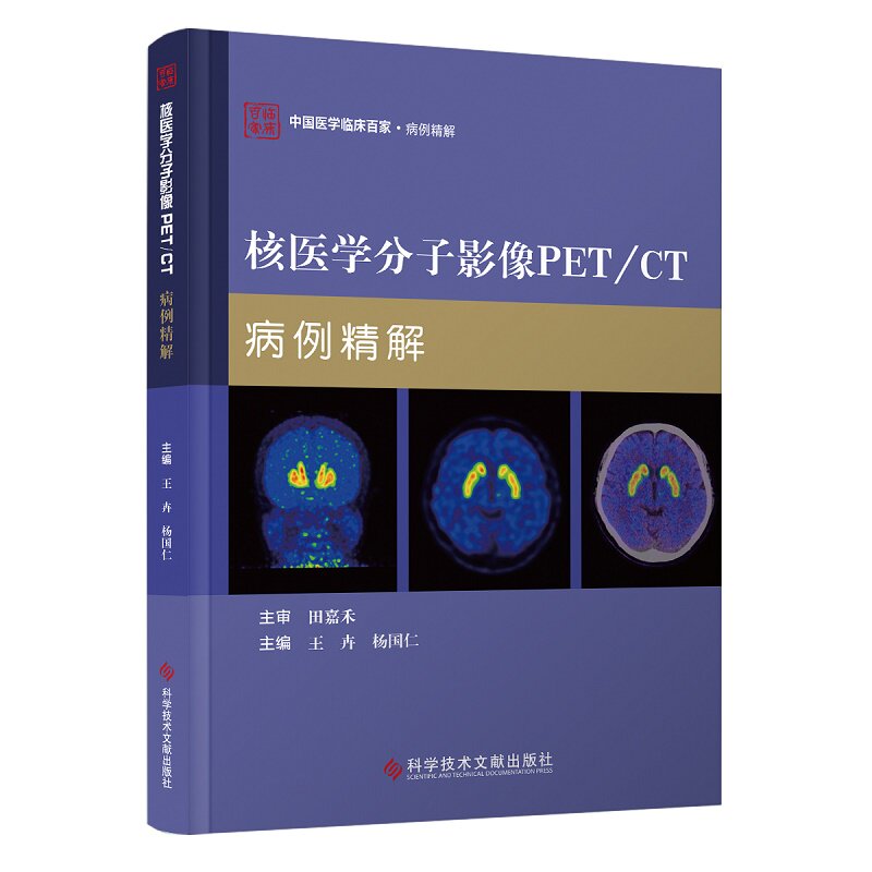 核医学分子影像PET/CT病例精解 王卉 杨国仁主编 科学技术文献出版社 中国医学临床百家 颅内原发性中枢神经系统淋巴瘤 亨廷顿病