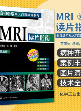 MRI读片指南 第三版 影像读片从入门到精通系列 范国光 杨峰 主编 化学工业出版社 颅内肿瘤 成人弥漫性胶质瘤 室管膜瘤