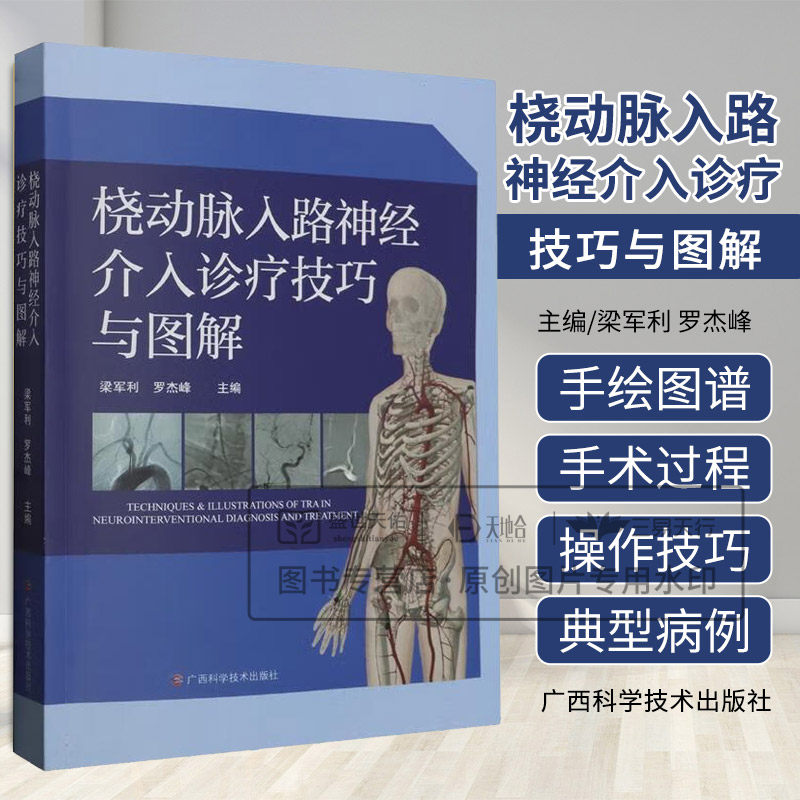 桡动脉入路神经介入诊疗技巧与图解 罗杰峰等 广西科学技术出版社 桡动脉入路脑血管病介入诊疗的手术过程及操作技巧