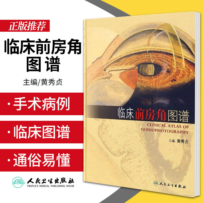 临床前房角图谱 黄秀贞 主编 人民卫生出版社 9787117123570 正常前房