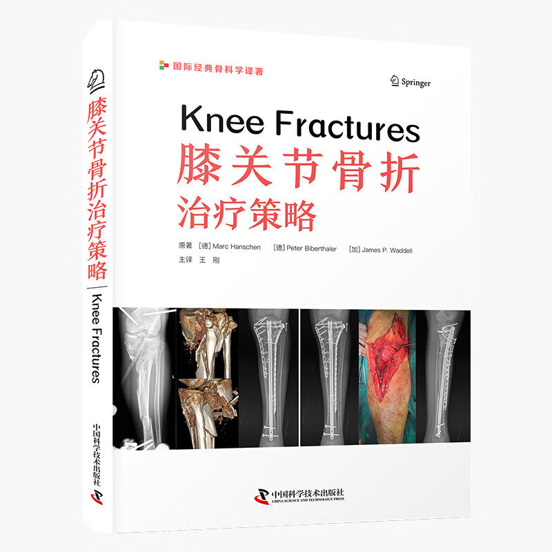 zgkj 膝关节骨折治疗策略 王刚主译 中国科学技术出版社 国际经典骨科学译著 膝关节的解剖 非感染性不愈合等并发症