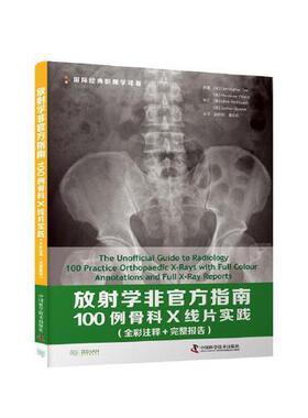 asy 放射学非官方指南100例骨科X线片实践:全彩注释+完整报告:with full colour annotations and full X-ray reports