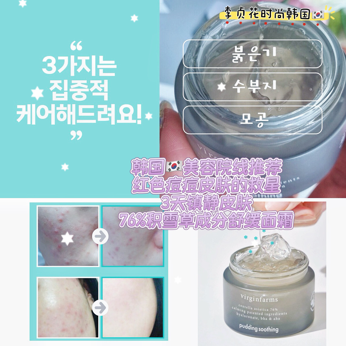 痘痘敏感肌救星~韩国直邮代购76%积雪草水润凝胶祛痘镇静皮肤面霜