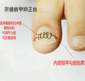 宗健嵌甲矫正丝正甲沟片矫正器修脚工具指甲长肉趾甲不锈钢炎 包邮