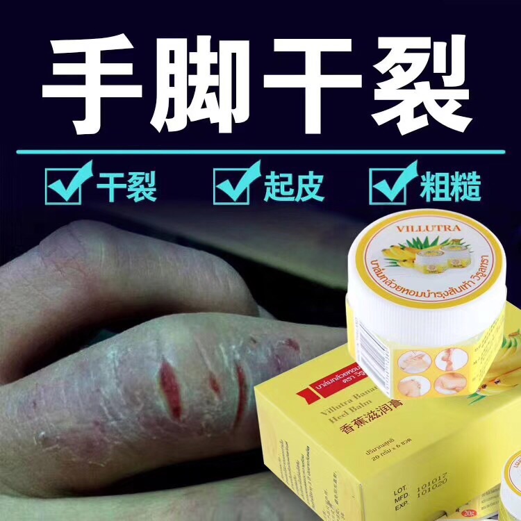 包邮泰国正品脚后跟龟裂手裂香蕉膏精霜 润肤护足霜 凡士林防裂膏