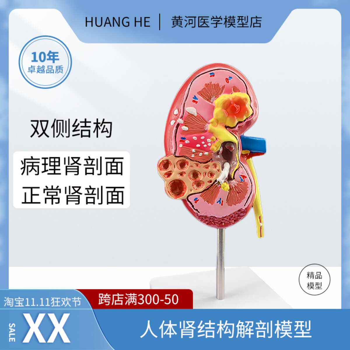 인간 신장 해부학 모델 병든 신장 모델 인간 장기 해부학 모델 병든 내부 장기 병원 교육