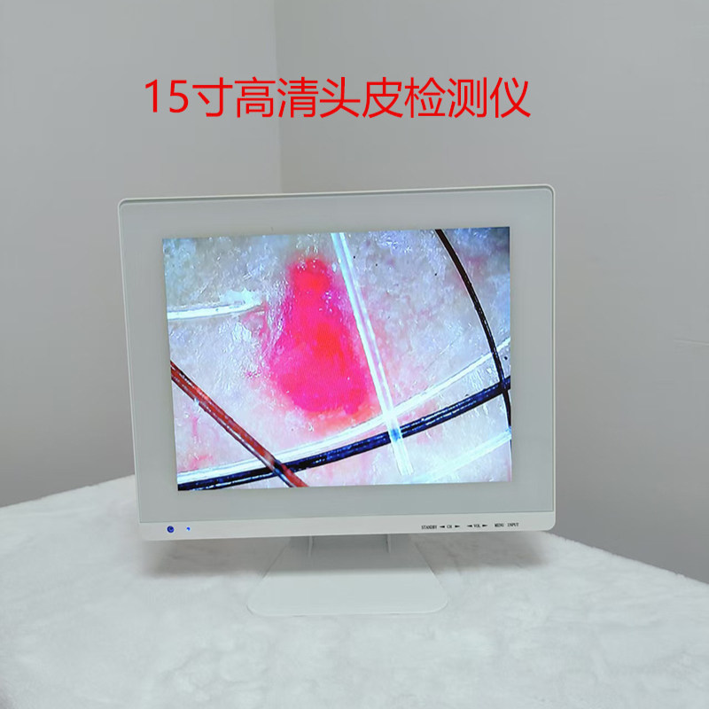 15寸头皮检测仪防脱育发白转黑辅助工具养发馆毛囊毛发测试机器