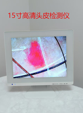 15寸头皮检测仪防脱育发白转黑辅助工具养发馆毛囊毛发测试机器