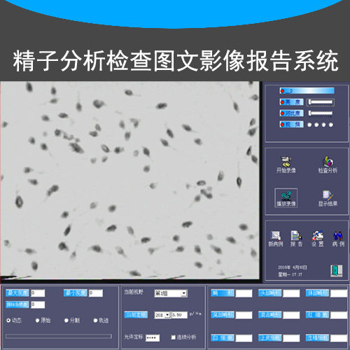 精子分析软件精子检查报告病历图文影像报告系统