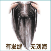 发块真发假发女中长直发发顶头顶补发无痕隐形自然中分刘海假发片