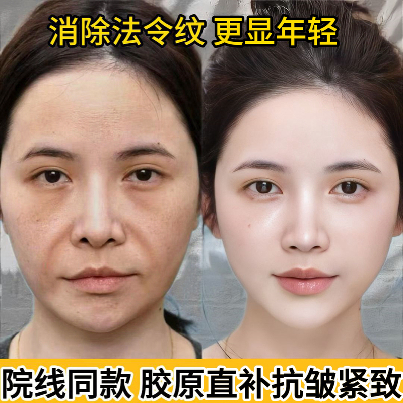 施逅微晶法令纹淡化细纹扛皱贴保湿紧致v脸提拉面膜法令纹贴
