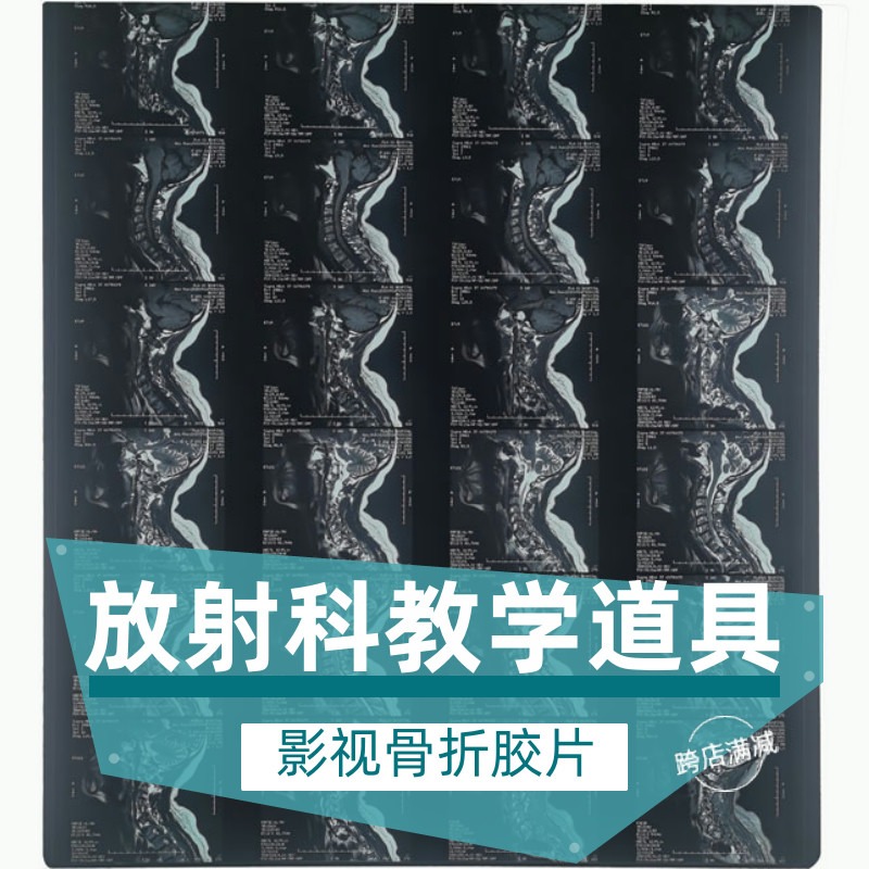 康智汇骨折胶片真实拍摄影视道具
