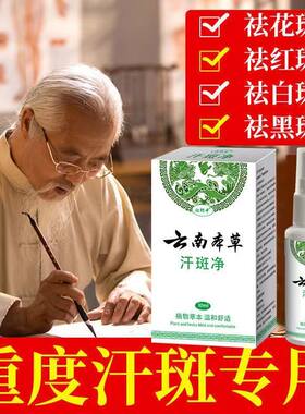 云南本草汗斑净专用皮肤汉斑皂花斑藓汗斑香露去喷剂药白斑膏