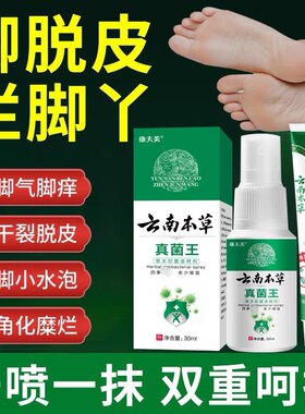 云南本草真菌王脚气脱皮真菌感染烂脚丫除臭喷剂脚痒水泡抑菌软膏