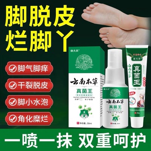 云南本草真菌王脚气脱皮真菌感染烂脚丫除臭喷剂脚痒水泡抑菌软膏