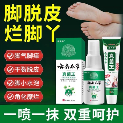 云南本草真菌王脚气脱皮真菌感染烂脚丫除臭喷剂脚痒水泡抑菌软膏