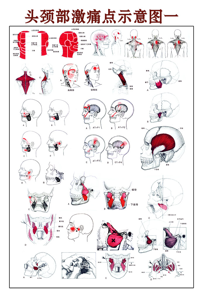 767骨骼骨架头颈部激痛点示意图1586海报印制展板写真喷绘挂图