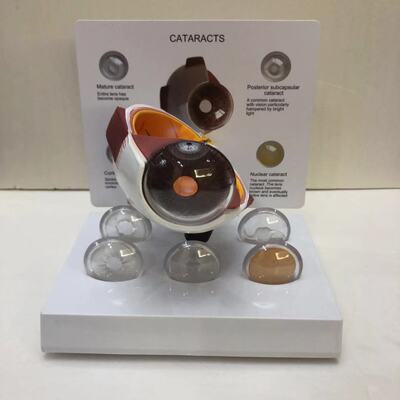 眼球模型  白内障眼球模型 眼球解剖眼疾病 眼球病变模型