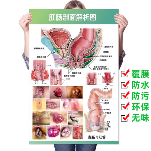 肛肠解剖图肛门直肠结构图痔疮肛肠常见疾病检查体位医学科普挂图