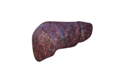 肝细胞癌 肝脏模型 医学解剖模型 3D三维模型 MAYA模型 FBX模型