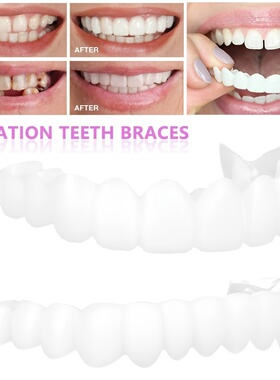 上牙下牙假牙牙套无孔牙套二代硅胶仿真牙齿snapon smile