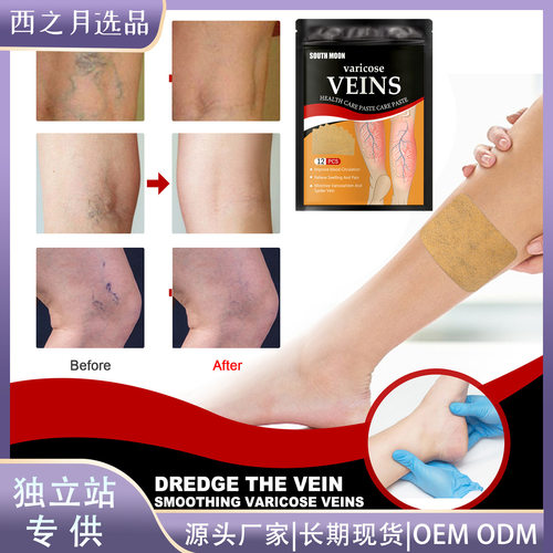 Vein health care patches to relieve varicose feet swelling e