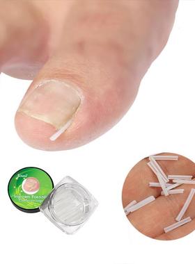 10PCS Silicone Ingrown Nail Pad Relief Pain Paronychia Corre