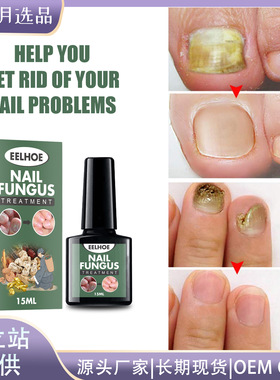 Grey Nail Liquid Hand & Foot Grey Nail Care Repair Thickenin