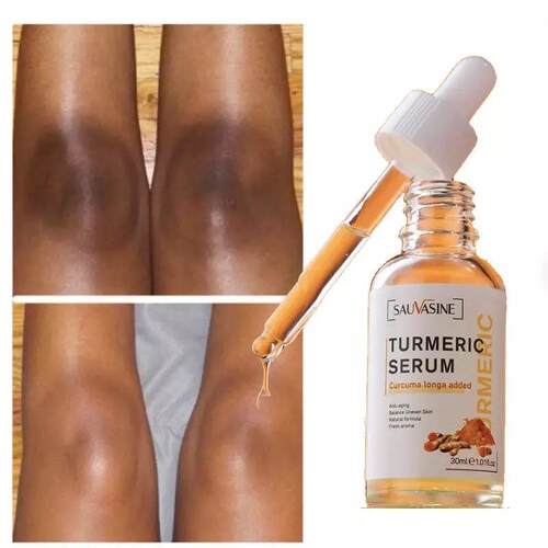 Turmeric Lemon Oil Skin Glow To Lightening Acne Dark Serum