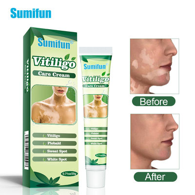 Sumifun Vitiligo Care Cream跨境 白斑膏 修复 K10046十盒