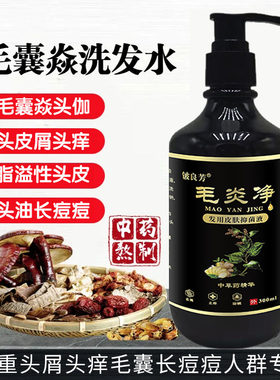 毛炎净洗发水去屑止痒严重头屑头痒控油除螨去头皮屑头皮痒洗发露