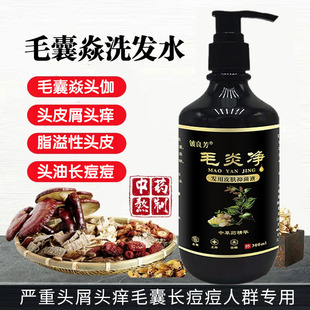毛炎净洗发水去屑止痒严重头屑头痒控油除螨去头皮屑头皮痒洗发露