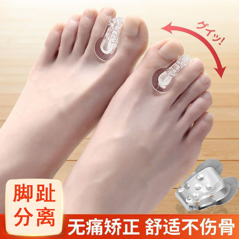 脚趾分趾器拇指外翻矫正器