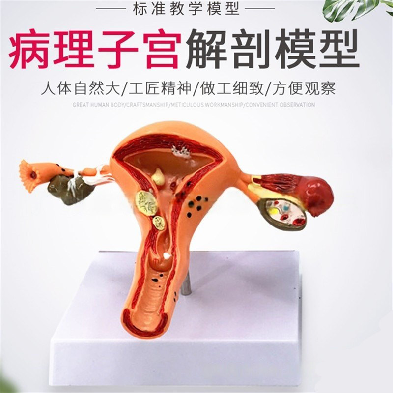 人体子宫模型教具模具阴道卵巢解剖病理医学女性仿真生殖模器教学