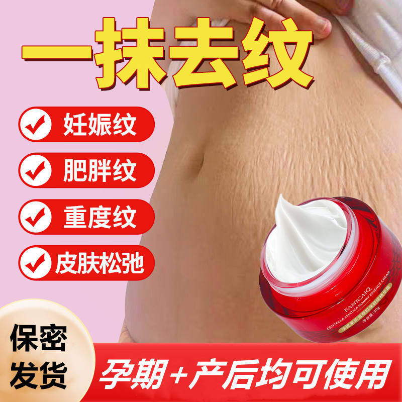 法妮采去妊娠纹修复霜积雪草妈咪舒纹精华霜产后抚纹消除膏正品