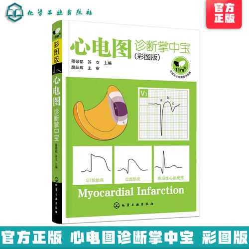 临床心电图诊断识图掌中宝