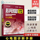 心电图诊断手册 判读心电图图谱临床心电图 彩图版 心电图诊断从入门到精通 心电图心内科应用书籍 临床医学理论心电图 官方正版