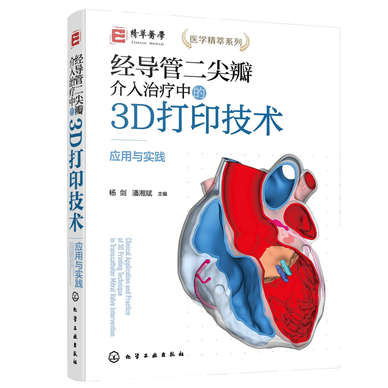 经导管二尖瓣介入治疗中的3D打印技术 应用与实践 杨剑 TMVI 生物医学工程学工作者阅读 外科医师麻醉放射学超声影像学等专业参考