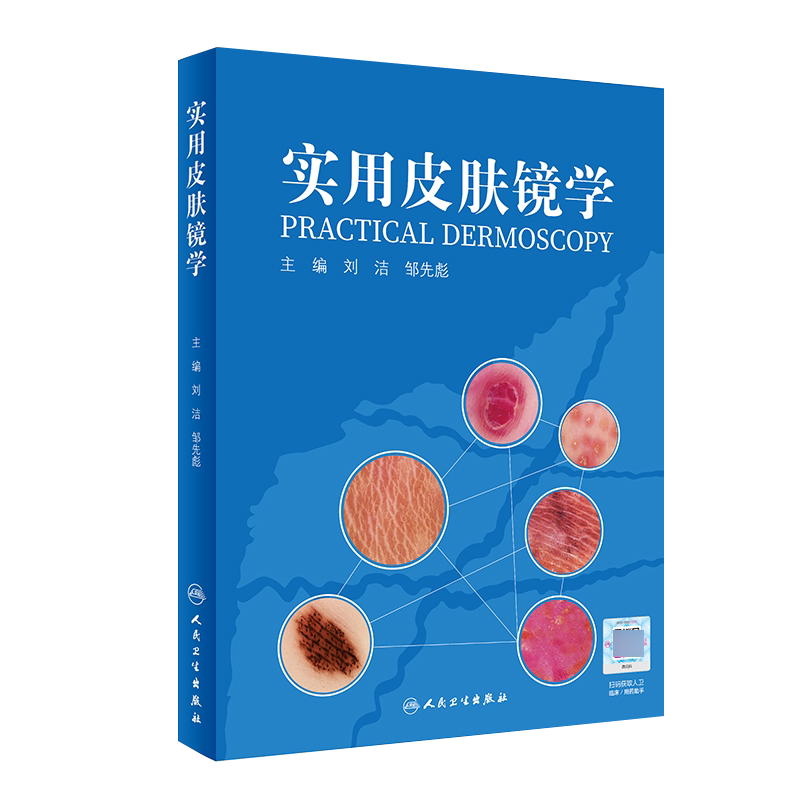 实用皮肤镜学诊断方法思路