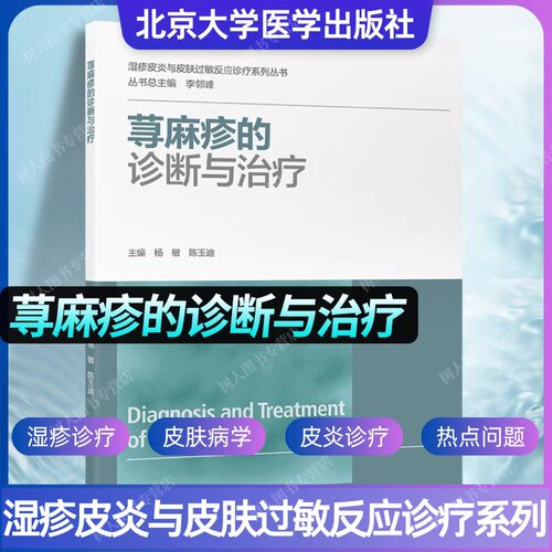 荨麻疹的诊断与治疗反应诊疗