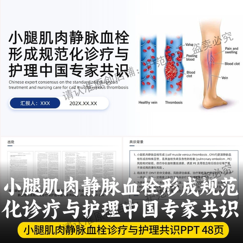 小腿肌肉静脉血栓形成规范化诊疗与护理中国专家共识PPT 2026最新