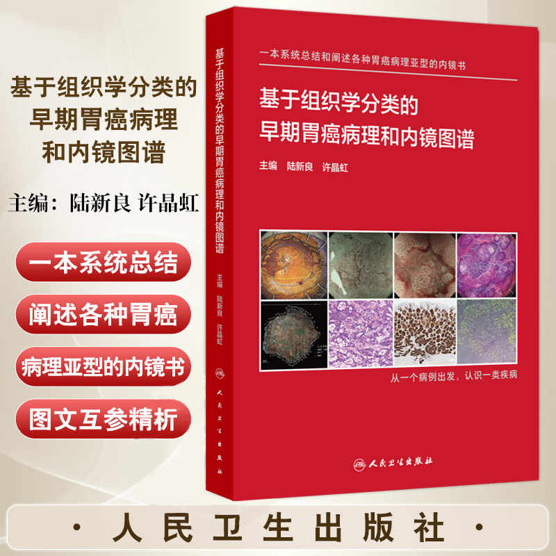 早期胃癌病理和内镜图谱