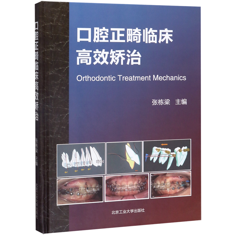 正版 口腔正畸临床高效矫治(精)张栋梁 口腔正畸学书籍口腔正畸专科教程口腔正畸临床治疗设计正畸材料 北京工业大学出版社